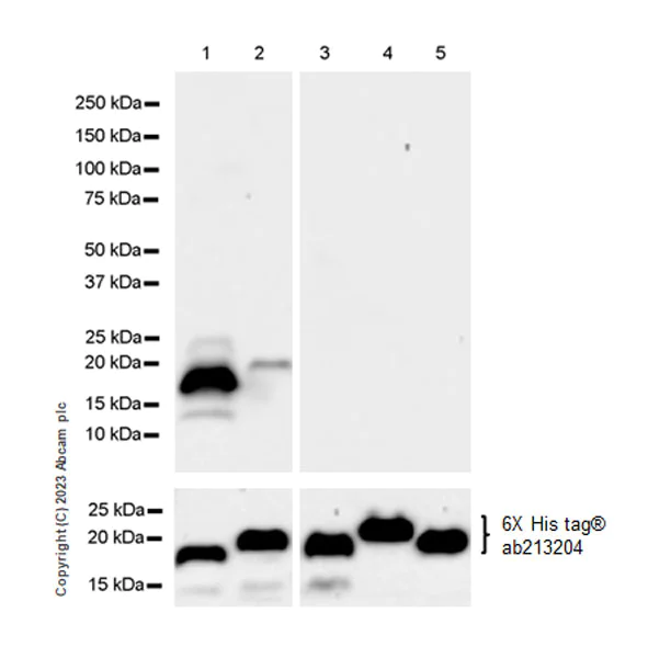 Western blot - Anti-HPV18 E7 antibody [EPR26911-29] (AB308296)