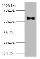 Western blot - Anti-HPV18 L1 antibody (AB267404), expandable thumbnail