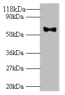 Western blot - Anti-HPV18 L1 antibody (AB267404)