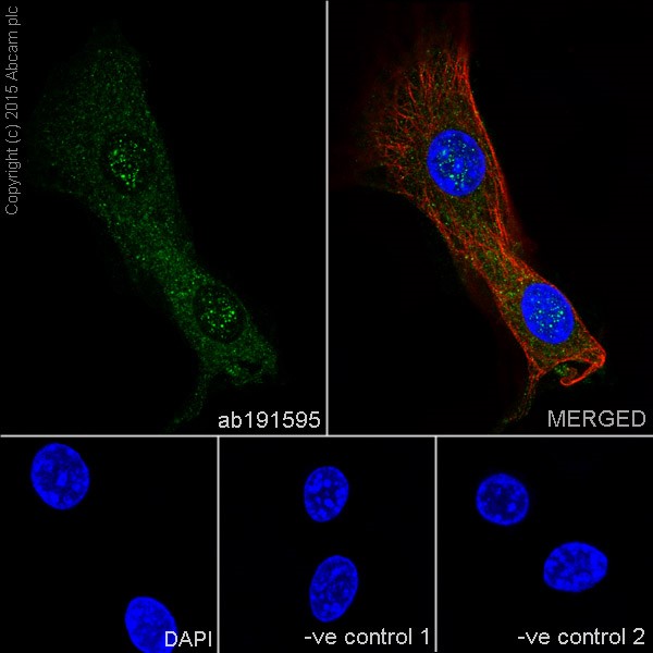 Immunocytochemistry/ Immunofluorescence - Anti-HRAS + KRAS antibody [EPR18713] - BSA and Azide free (AB240323), expandable thumbnail