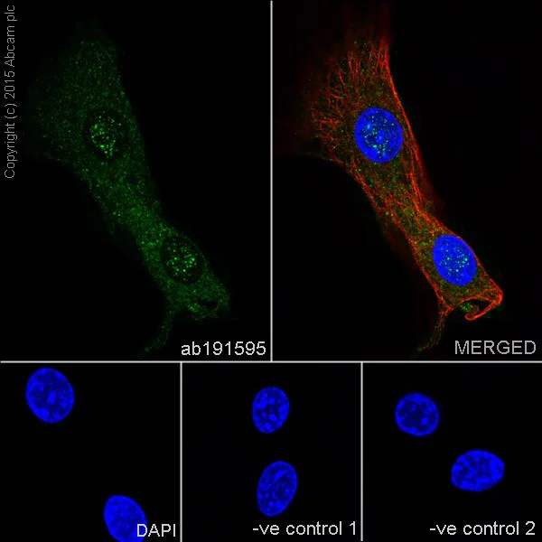 Immunocytochemistry/ Immunofluorescence - Anti-HRAS + KRAS antibody [EPR18713] - BSA and Azide free (AB240323)