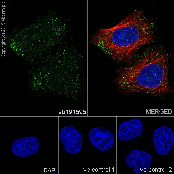 Immunocytochemistry/ Immunofluorescence - Anti-HRAS + KRAS antibody [EPR18713] - BSA and Azide free (AB240323)