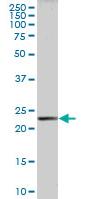 Western blot - Anti-HRASLS3 antibody (AB88447)