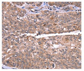 Immunohistochemistry (Formalin/PFA-fixed paraffin-embedded sections) - Anti-HRG antibody (AB198920)