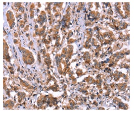 Immunohistochemistry (Formalin/PFA-fixed paraffin-embedded sections) - Anti-HRG antibody (AB198920)
