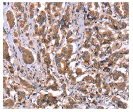 Immunohistochemistry (Formalin/PFA-fixed paraffin-embedded sections) - Anti-HRG antibody (AB198920)