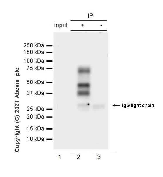 Immunoprecipitation - Anti-HRG antibody [EPR24184-52] - BSA and Azide free (AB281572)