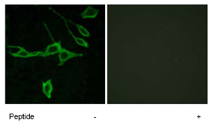 Immunocytochemistry/ Immunofluorescence - Anti-HRH1/H1R antibody (AB75236)