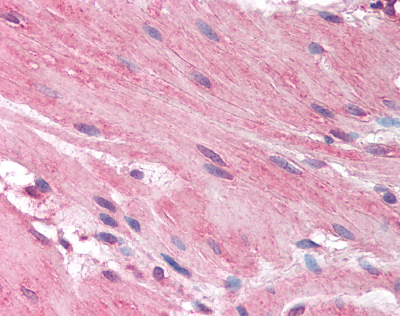 Immunohistochemistry (Formalin/PFA-fixed paraffin-embedded sections) - Anti-HRH1/H1R antibody (AB78224), expandable thumbnail