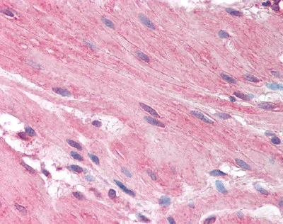 Immunohistochemistry (Formalin/PFA-fixed paraffin-embedded sections) - Anti-HRH1/H1R antibody (AB78224)