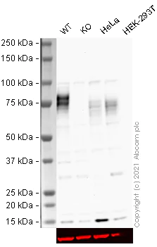Western blot - HRP Anti-5T4 antibody [EPR5530] (AB199547)