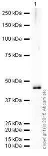 Western blot - HRP Anti-6X His tag® antibody [4D11] (AB202004), expandable thumbnail