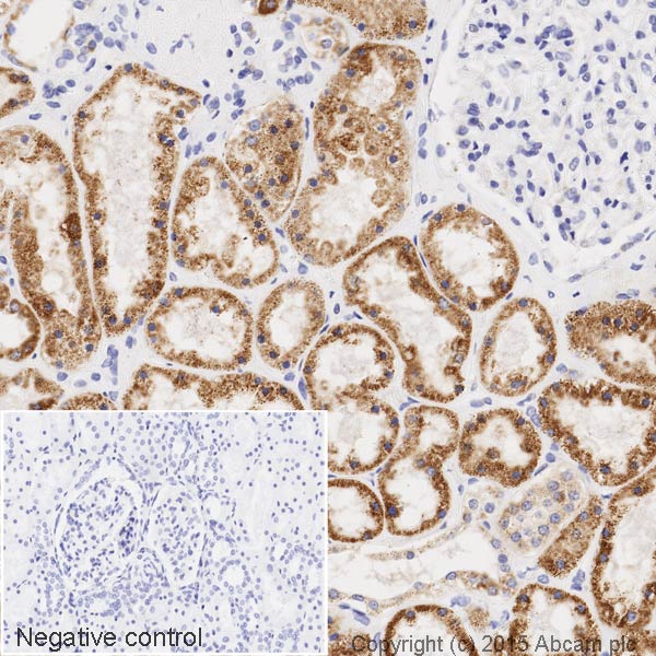Immunohistochemistry (Formalin/PFA-fixed paraffin-embedded sections) - HRP Anti-ACADM/MCAD antibody [EPR3708] (AB203465)