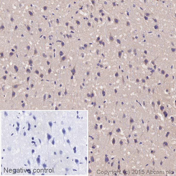 Immunohistochemistry (Formalin/PFA-fixed paraffin-embedded sections) - HRP Anti-ADRA1B antibody [EPR10336] (AB202936), expandable thumbnail