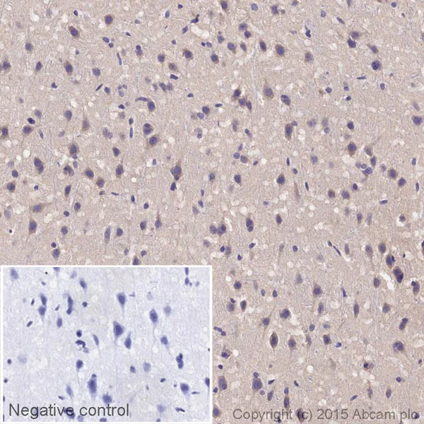 Immunohistochemistry (Formalin/PFA-fixed paraffin-embedded sections) - HRP Anti-ADRA1B antibody [EPR10336] (AB202936)