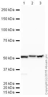 Western blot - HRP Anti-ADRA1B antibody [EPR10336] (AB202936)