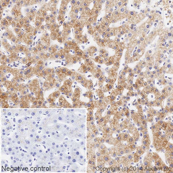 Immunohistochemistry (Formalin/PFA-fixed paraffin-embedded sections) - HRP Anti-AKR1C1/AKR1C2 antibody [4B6AF3] (AB198411), expandable thumbnail