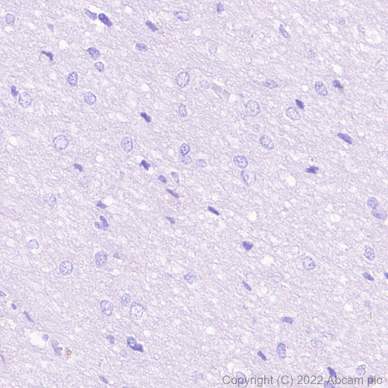 Immunohistochemistry (Formalin/PFA-fixed paraffin-embedded sections) - HRP Anti-Albumin antibody [EPR12774] (AB307472)