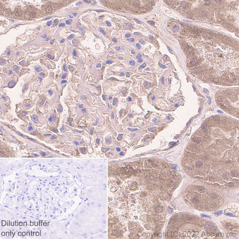 Immunohistochemistry (Formalin/PFA-fixed paraffin-embedded sections) - HRP Anti-Albumin antibody [EPR12774] (AB307472)