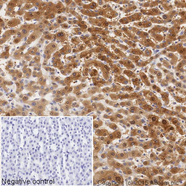 Immunohistochemistry (Formalin/PFA-fixed paraffin-embedded sections) - HRP Anti-Alcohol Dehydrogenase antibody [EPR4439] (AB202951)