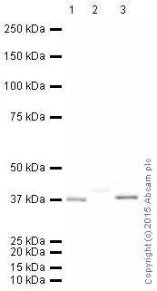 Western blot - HRP Anti-Alcohol Dehydrogenase antibody [EPR4439] (AB202951)
