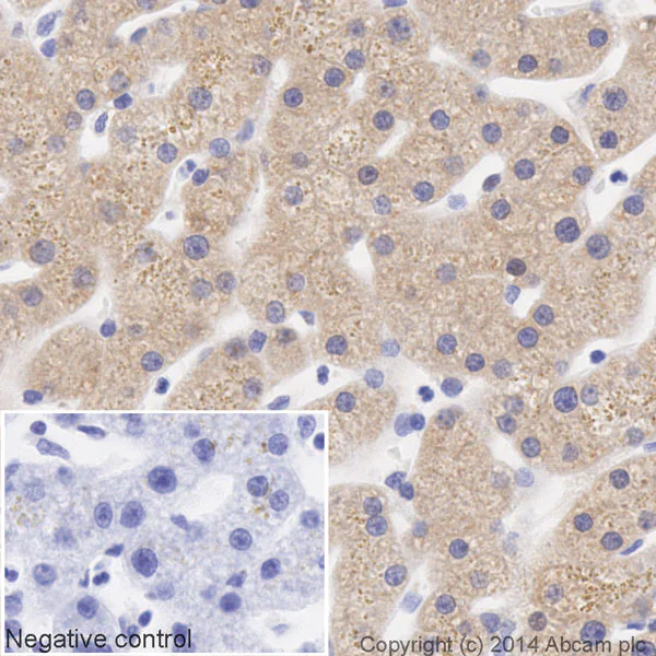 Immunohistochemistry (Formalin/PFA-fixed paraffin-embedded sections) - HRP Anti-ALDH1A1 antibody [EP1933Y] (AB195517)