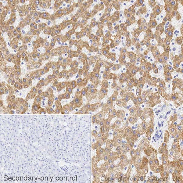 Immunohistochemistry (Formalin/PFA-fixed paraffin-embedded sections) - HRP Anti-ALDH5A1/SSADH antibody [EPR7794] (AB314408)