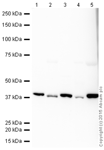 Western blot - HRP Anti-Aldolase + Aldolase B + Aldolase C antibody [EPR9724(B)] (AB200774), expandable thumbnail