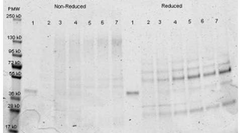 Immunoprecipitation - HRP Anti-Aldolase antibody (AB181662), expandable thumbnail
