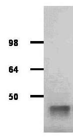 Western blot - HRP Anti-Aldolase antibody (AB181662), expandable thumbnail