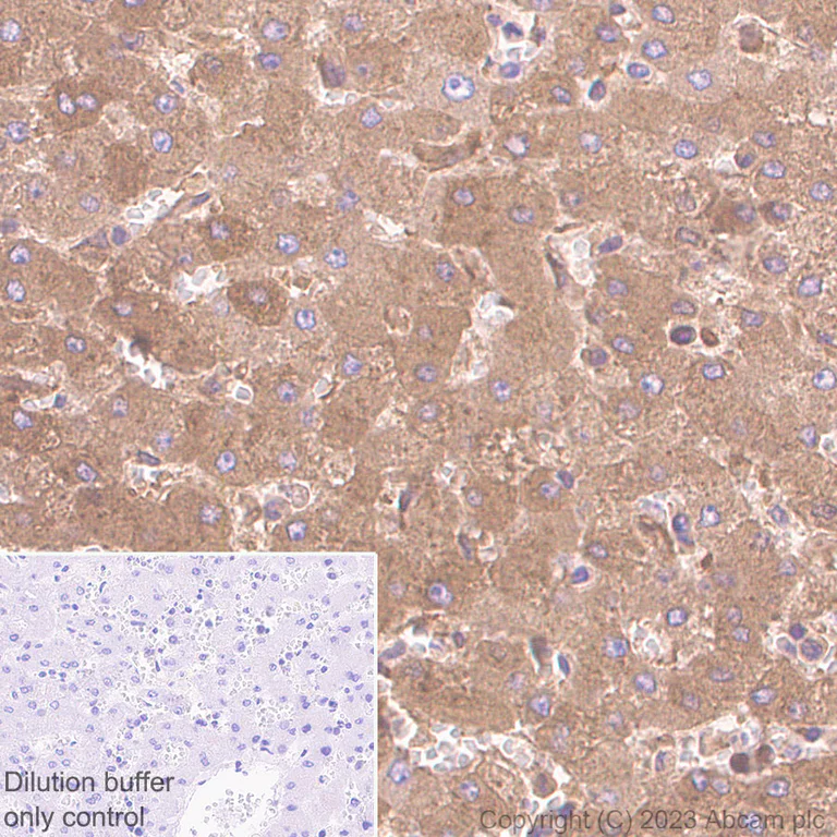 Immunohistochemistry (Formalin/PFA-fixed paraffin-embedded sections) - HRP Anti-alpha 1 Antitrypsin antibody [EPR17087-50] (AB309499)