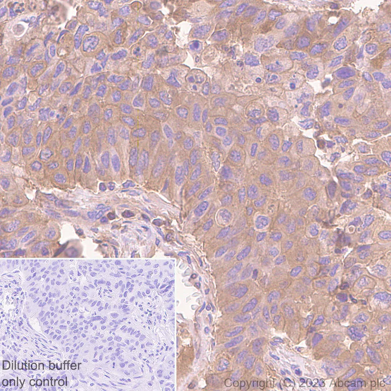 Immunohistochemistry (Formalin/PFA-fixed paraffin-embedded sections) - HRP Anti-alpha 1 Antitrypsin antibody [EPR17087-50] (AB309499)