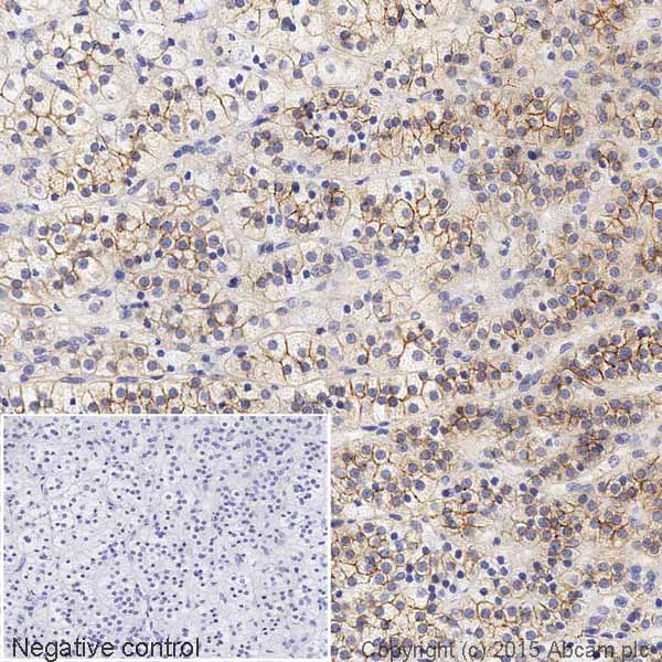 Immunohistochemistry (Formalin/PFA-fixed paraffin-embedded sections) - HRP Anti-alpha Actinin 4 antibody [EPR2533(2)] - Loading Control (AB199072)