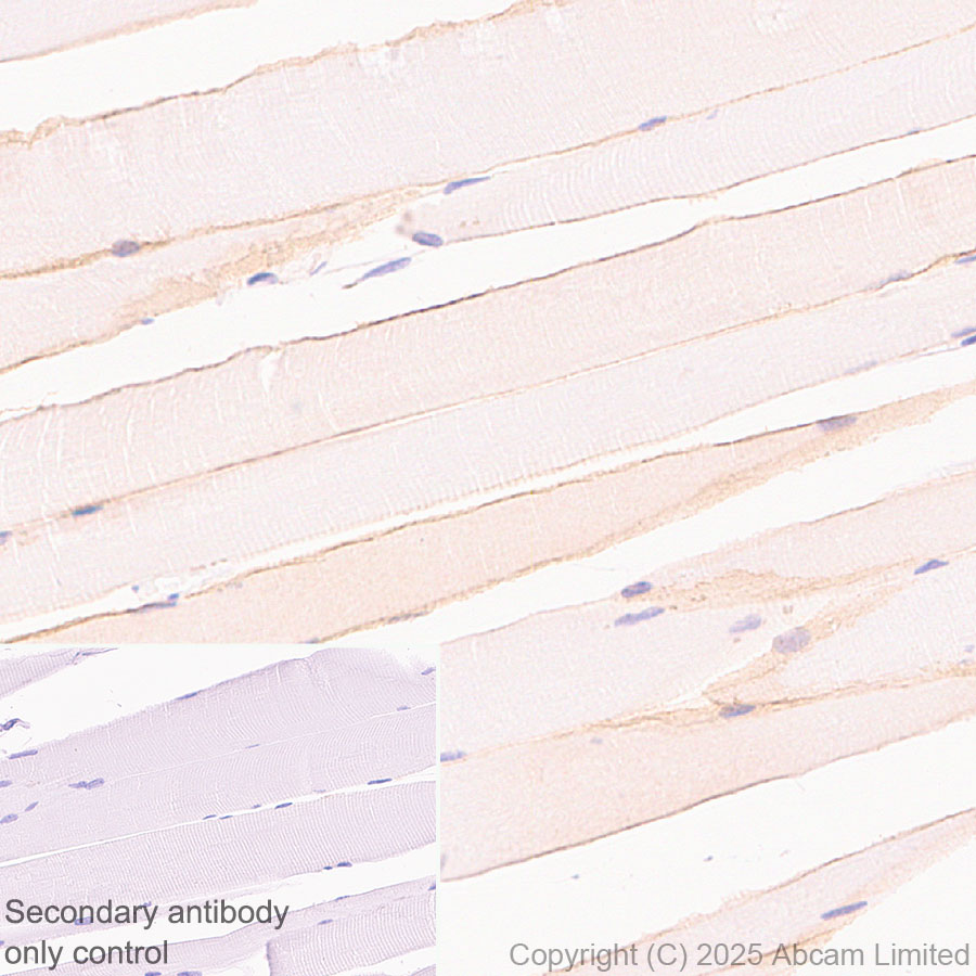 Immunohistochemistry (Formalin/PFA-fixed paraffin-embedded sections) - HRP Anti-alpha Sarcoglycan antibody [EPR14773] (AB323780), expandable thumbnail