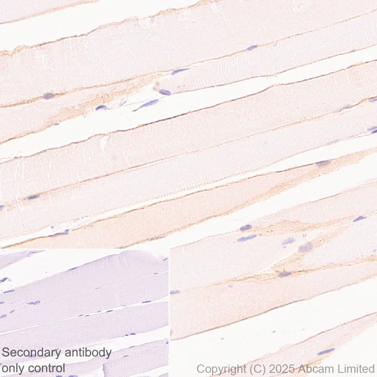 Immunohistochemistry (Formalin/PFA-fixed paraffin-embedded sections) - HRP Anti-alpha Sarcoglycan antibody [EPR14773] (AB323780)