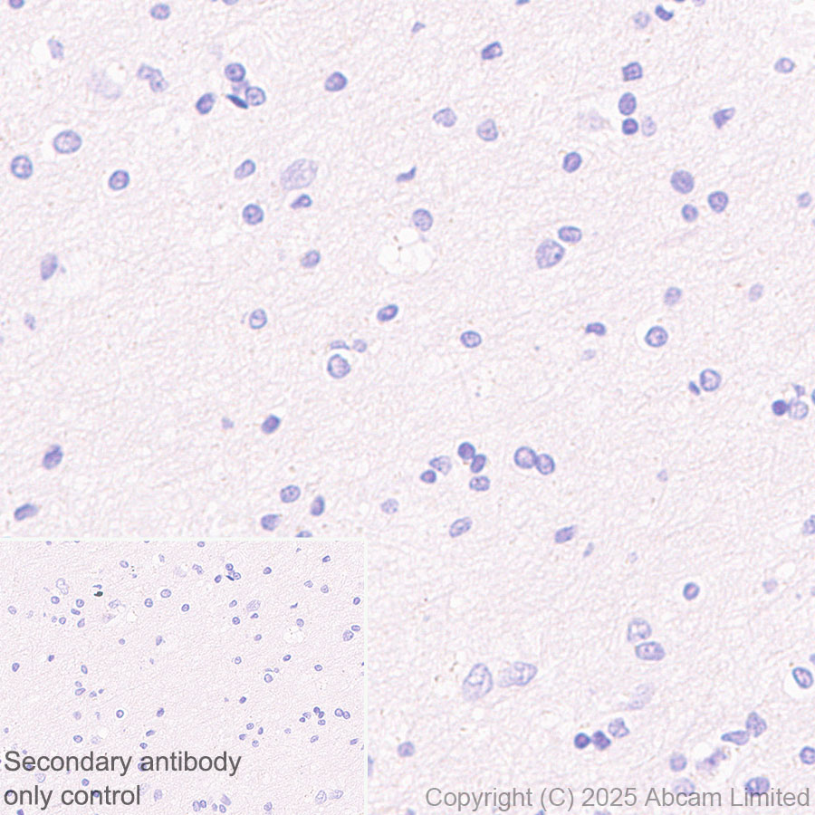 Immunohistochemistry (Formalin/PFA-fixed paraffin-embedded sections) - HRP Anti-alpha Sarcoglycan antibody [EPR14773] (AB323780), expandable thumbnail