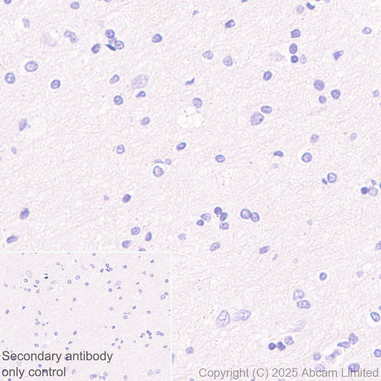 Immunohistochemistry (Formalin/PFA-fixed paraffin-embedded sections) - HRP Anti-alpha Sarcoglycan antibody [EPR14773] (AB323780)