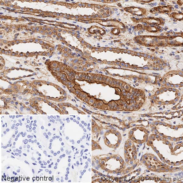 Immunohistochemistry (Formalin/PFA-fixed paraffin-embedded sections) - HRP Anti-alpha smooth muscle Actin (acetyl E3) + ACTG2 (acetyl E3) antibody [E184] (AB196920), expandable thumbnail