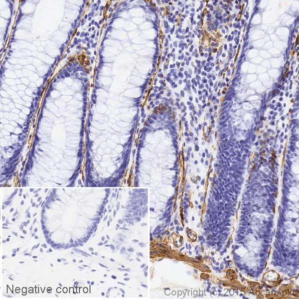 Immunohistochemistry (Formalin/PFA-fixed paraffin-embedded sections) - HRP Anti-alpha smooth muscle Actin antibody [1A4] (AB203696)