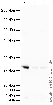 Western blot - HRP Anti-alpha smooth muscle Actin antibody [1A4] (AB203696)