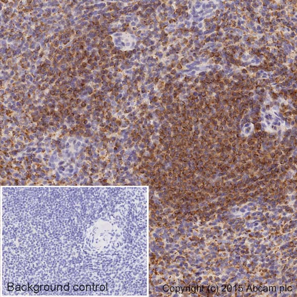 Immunohistochemistry (Formalin/PFA-fixed paraffin-embedded sections) - HRP Anti-alpha Tubulin antibody [EPR13478(B)] - Loading Control (AB185067), expandable thumbnail