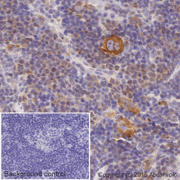 Immunohistochemistry (Formalin/PFA-fixed paraffin-embedded sections) - HRP Anti-alpha Tubulin antibody [EPR13478(B)] - Loading Control (AB185067), expandable thumbnail