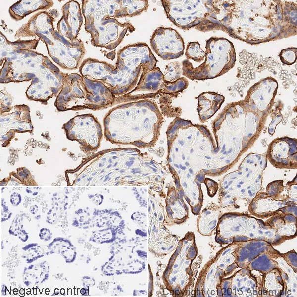 Immunohistochemistry (Formalin/PFA-fixed paraffin-embedded sections) - HRP Anti-ALPP+ALPG+ALPI antibody [EPR6141] (AB198554)