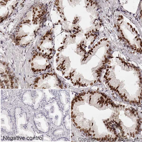 Immunohistochemistry (Formalin/PFA-fixed paraffin-embedded sections) - HRP Anti-Androgen Receptor antibody [EPR1535(2)] (AB194196)