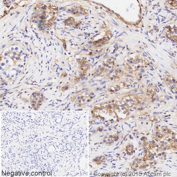 Immunohistochemistry (Formalin/PFA-fixed paraffin-embedded sections) - HRP Anti-Annexin-2/ANXA2 antibody [EPR13052(B)] (AB200798)