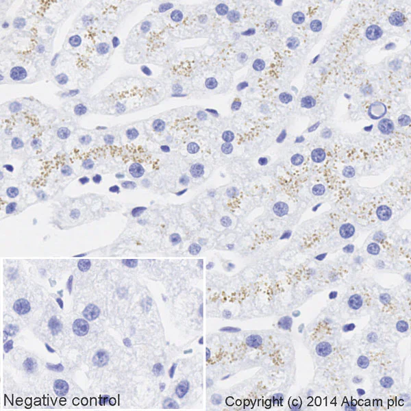 Immunohistochemistry (Formalin/PFA-fixed paraffin-embedded sections) - HRP Anti-Apolipoprotein E antibody [EP1374Y] (AB195855)