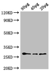 Western blot - HRP Anti-APX2 antibody (AB192968), expandable thumbnail