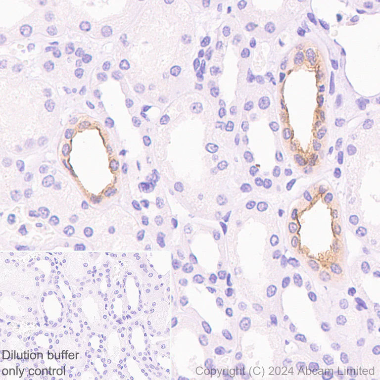 Immunohistochemistry (Formalin/PFA-fixed paraffin-embedded sections) - HRP Anti-Aquaporin 2 antibody [EPR21080] (AB325038)