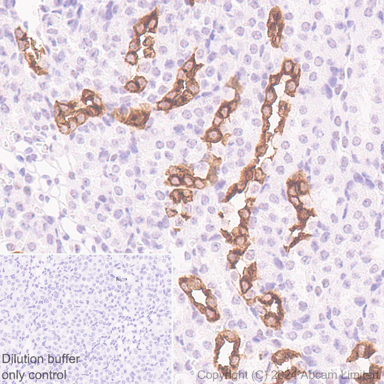 Immunohistochemistry (Formalin/PFA-fixed paraffin-embedded sections) - HRP Anti-Aquaporin 2 antibody [EPR21080] (AB325038)