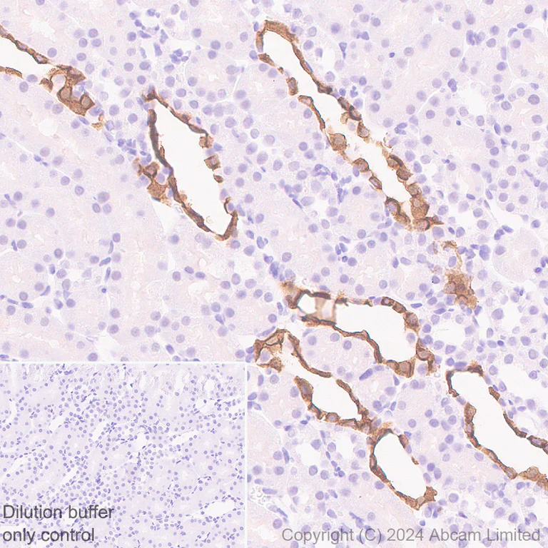 Immunohistochemistry (Formalin/PFA-fixed paraffin-embedded sections) - HRP Anti-Aquaporin 2 antibody [EPR21080] (AB325038)